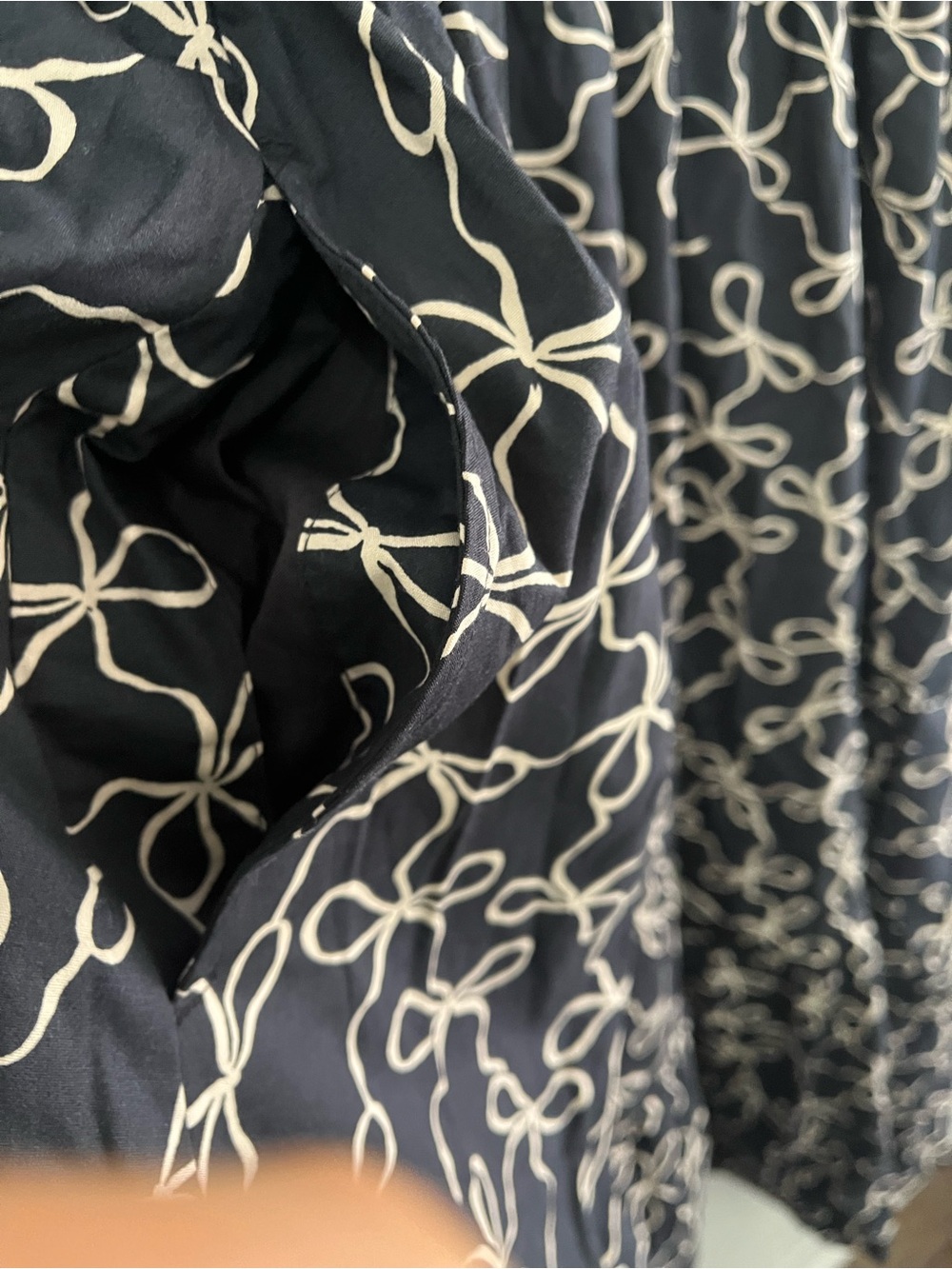Abercrombie & Fitch Black Midi Dress with Cream Swirl Print - Picture 6 of 13